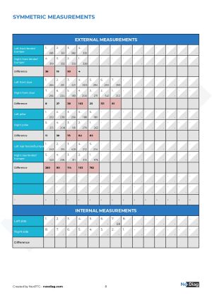 Ford Escort RS Turbo - 1987