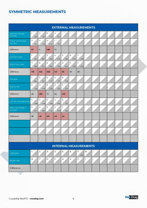 Citroën AX Sport - 1990